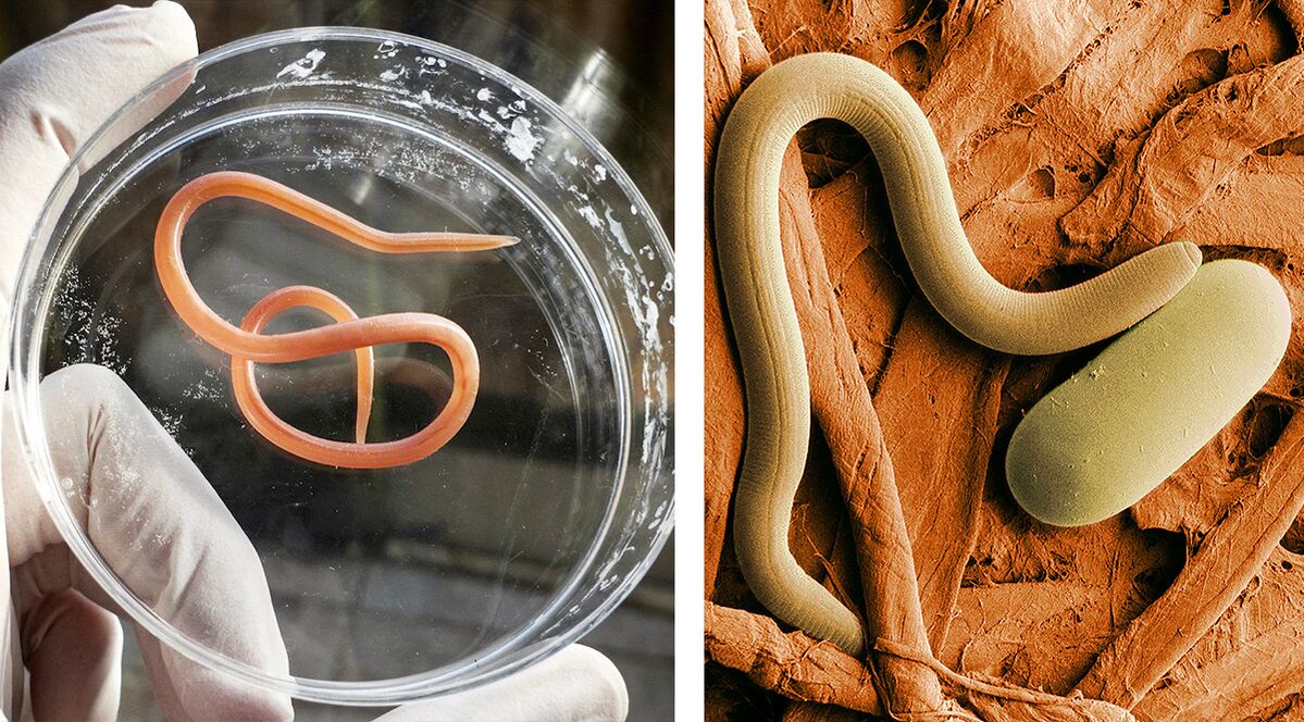 parazita u ljudskom tijelu