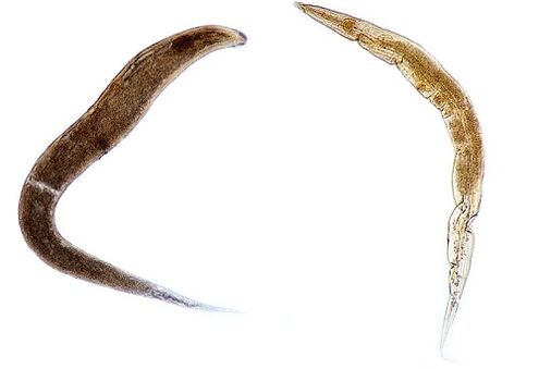 ljudski paraziti pinworms