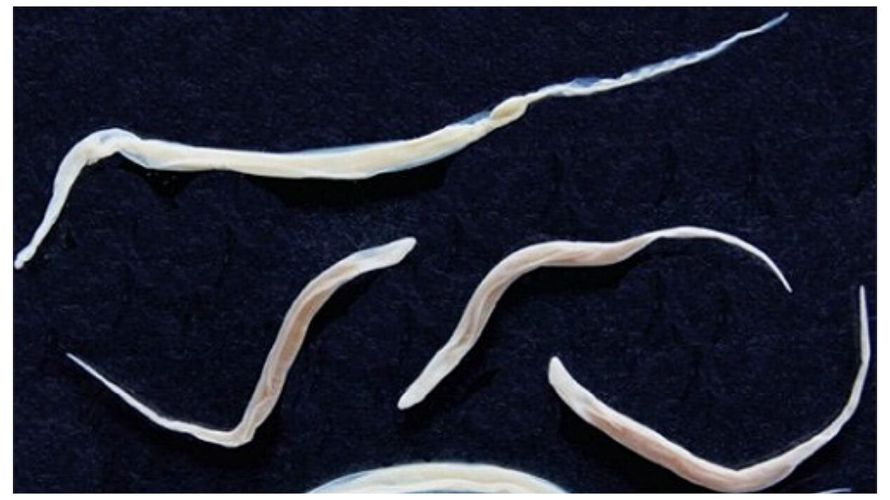 Pinworms su uobičajeni paraziti koji pripadaju skupini helminta.