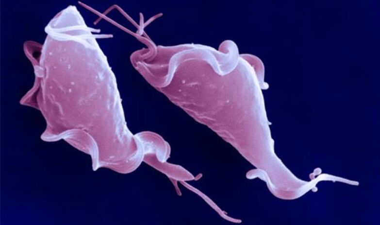Trichomonas vaginalis je protozojski parazit koji uzrokuje neplodnost.